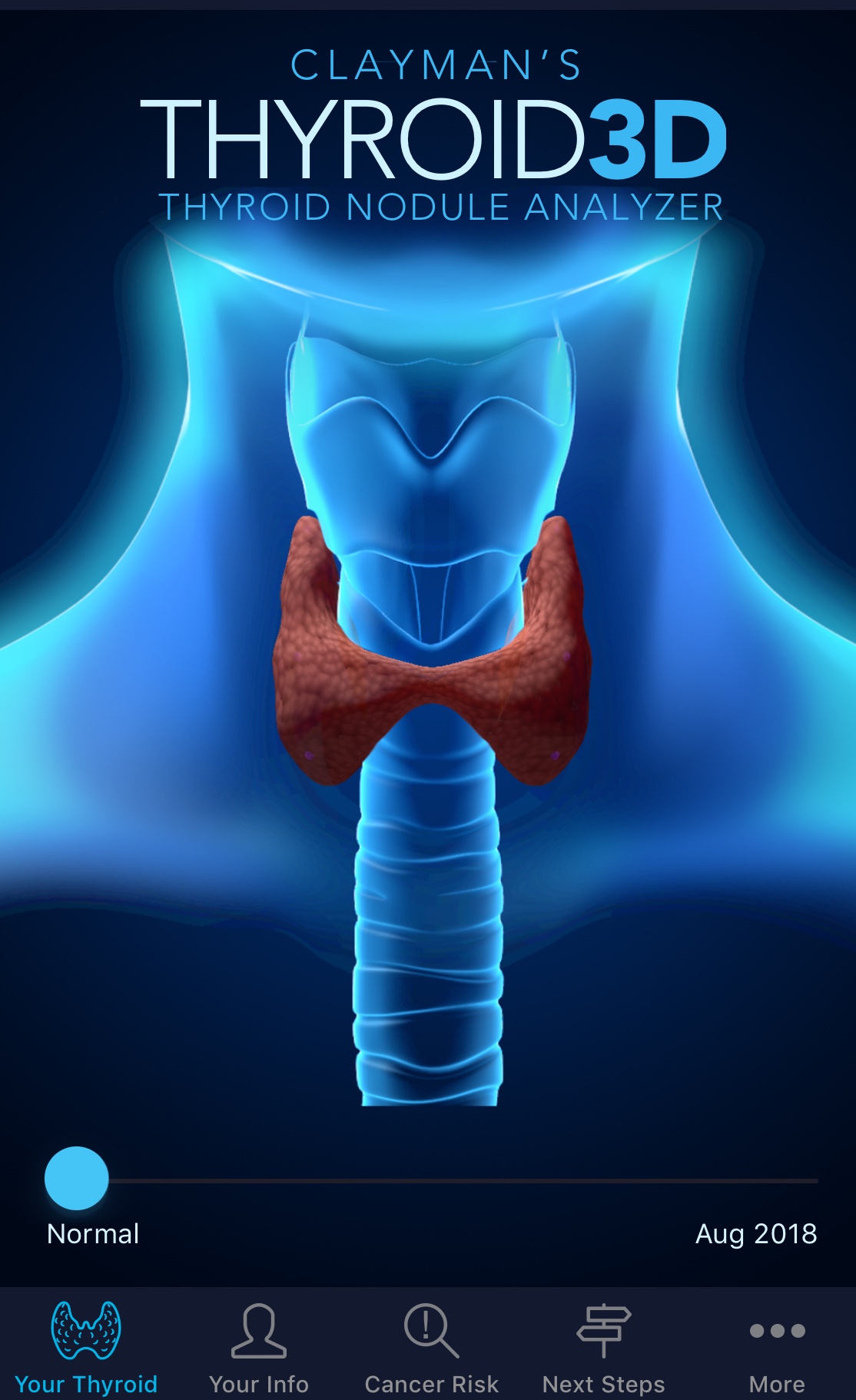 Clayman's Thyroid 3D App