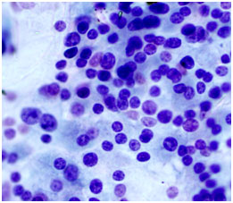 cytology slide showing thyroid cells