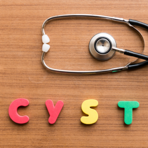 Top+four+facts+about+thyroid+cysts+by+dr+gary+clayman